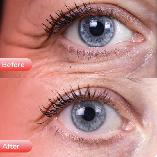 SOLOREDLIGHT™ LED Eye Rejuvenator | Anti-Aging, Fine Lines & Wrinkle Reduction, Mood & Sleep Improvement