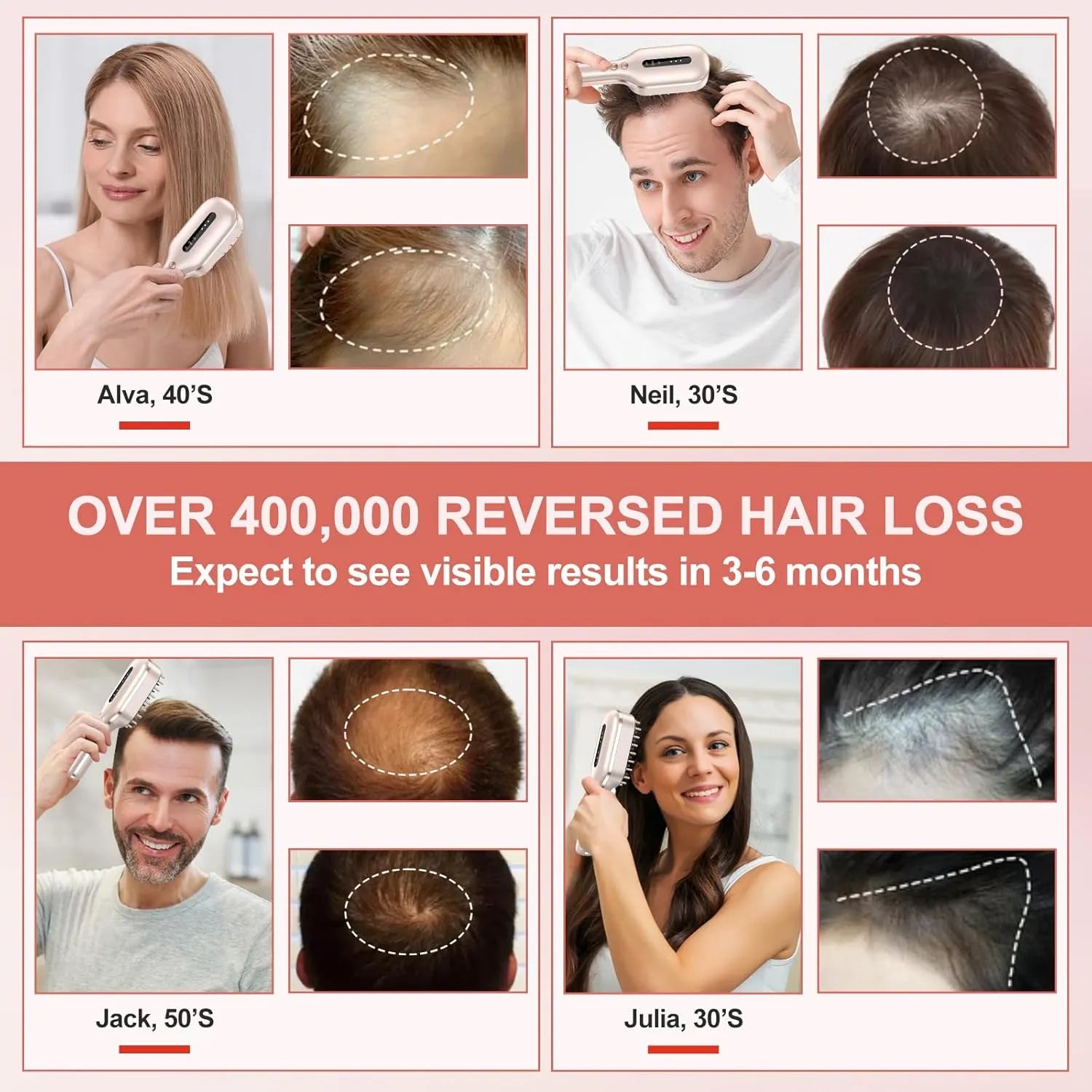 SOLOREDLIGHT™ Laser Therapy Hair Growth Comb with RF, EMS, Ultrasonic Vibration and IPX6 Water Resistance