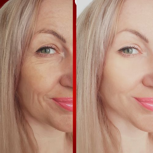 Red Light Therapy Results for Skin: Complete Benefits Guide
