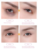Silicone Red & Infrared LED Eye Mask for Dark Circles & Wrinkles